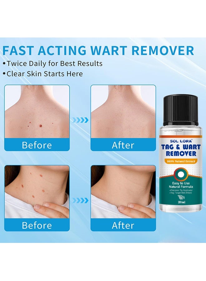 SOL LORA Natural & Safe Wart And Mole Remover Liquid, Wart Remover Liquid, Salicylic Acid Fast-Acting Formula For Plantar Warts, Skin Tags, Corns & Callus Removal, Pain-Free Scar-Free Treatment, Toes & Foot Care For Men & Women, 20ml - Image 4